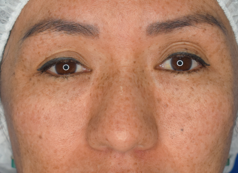 Before Image