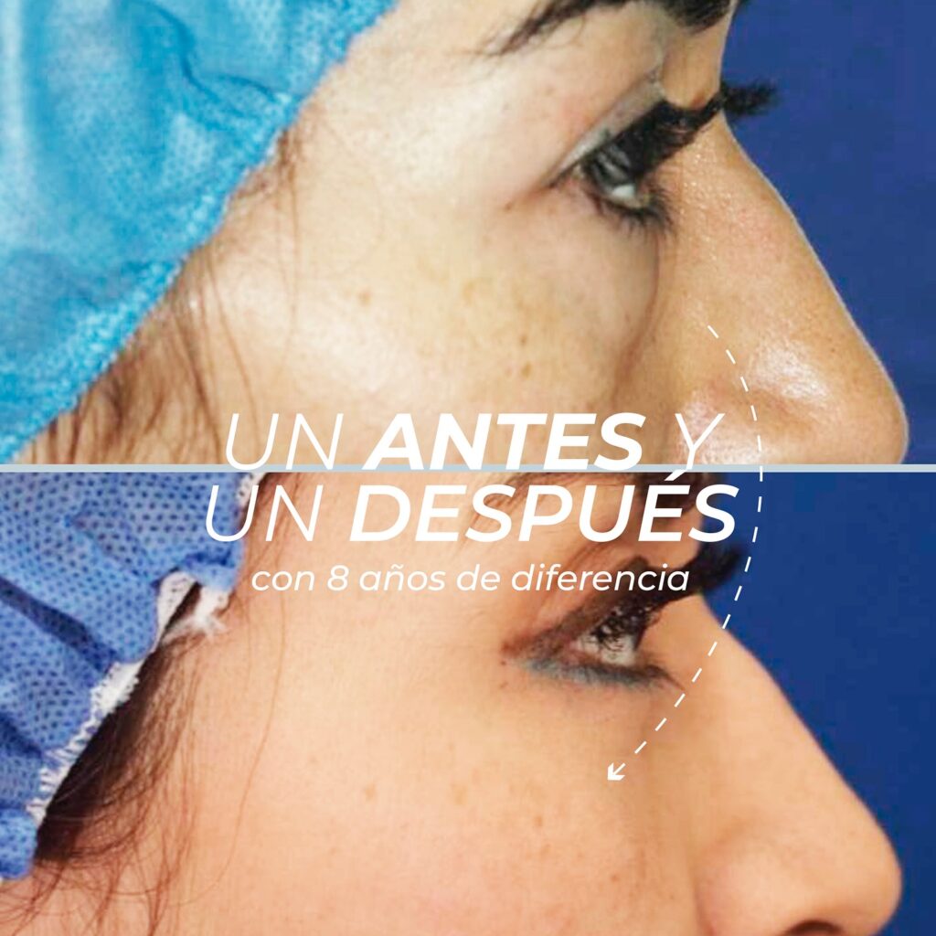 Antiedad 3