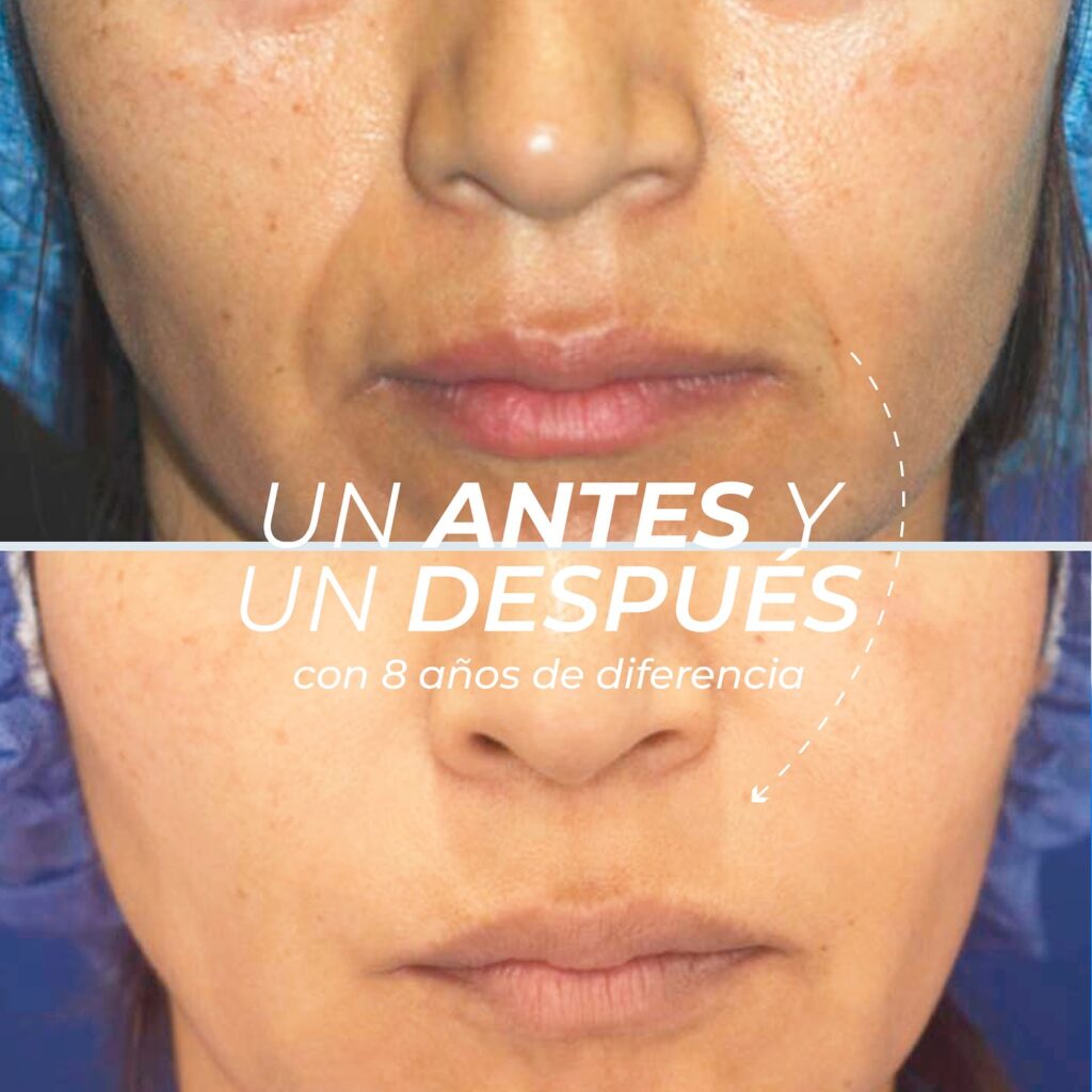 Antiedad 2