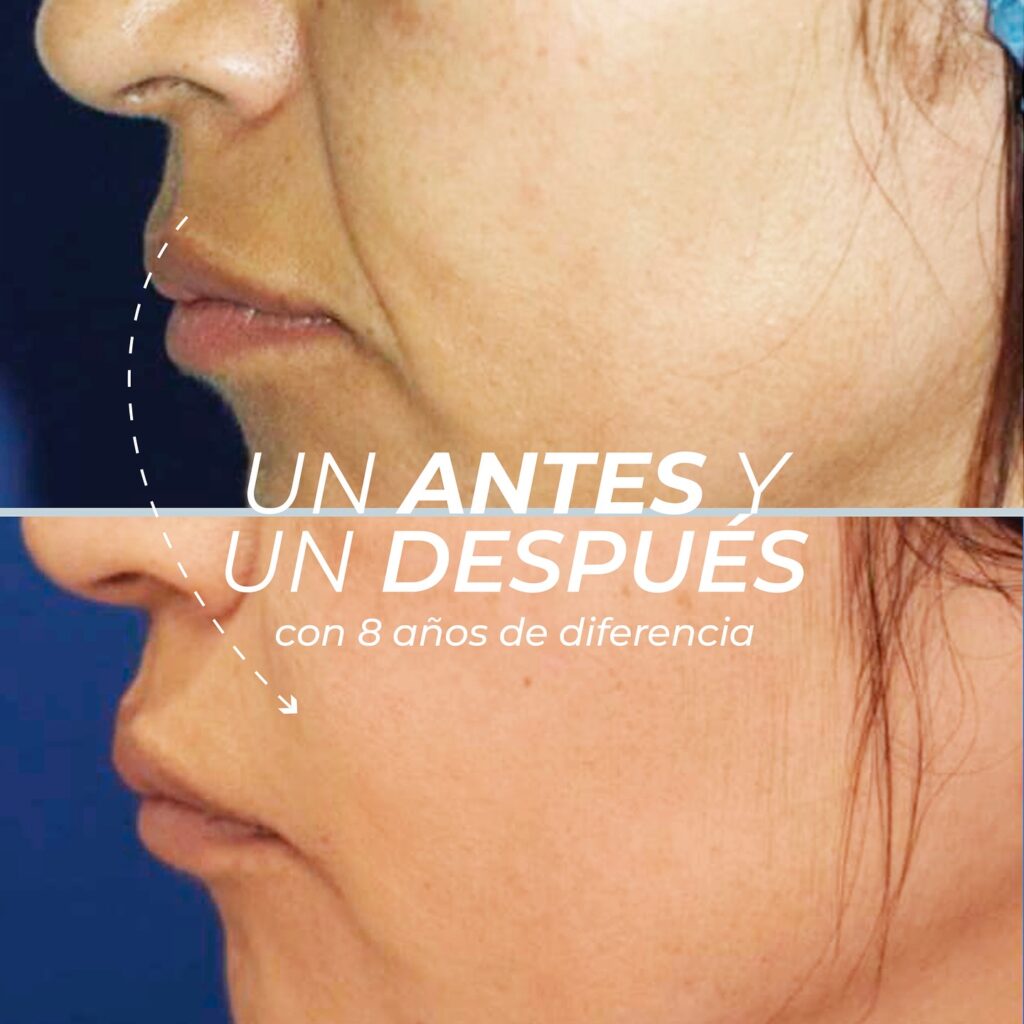 Antiedad 4