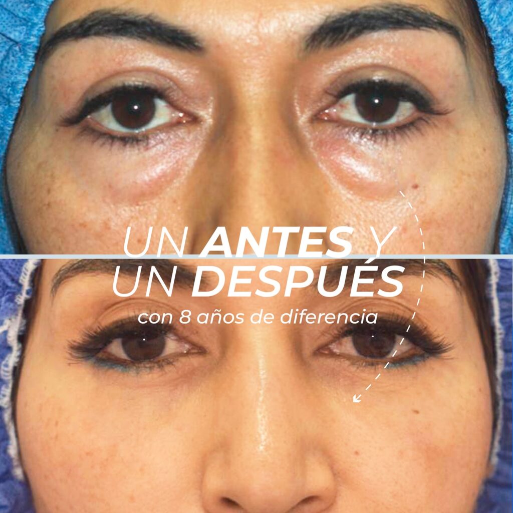 Antiedad