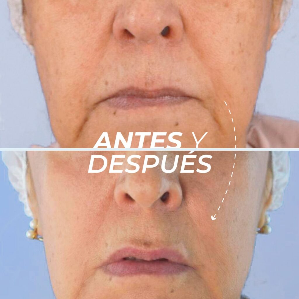 Cuello y contorno facial