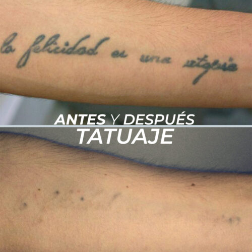 Antes y después