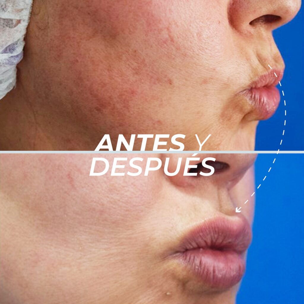 Labios