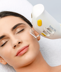Ipl m22 stellar dermosalud